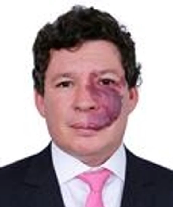 Reginaldo Lopes